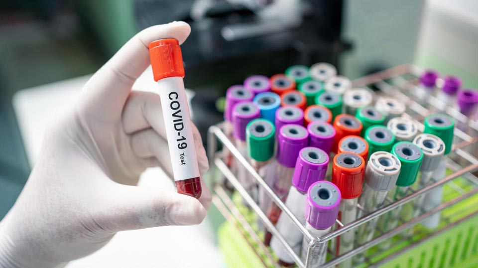 Ukraynada son 24 saat ərzində koronavirusun 14 580 yeni halı aşkar edildi