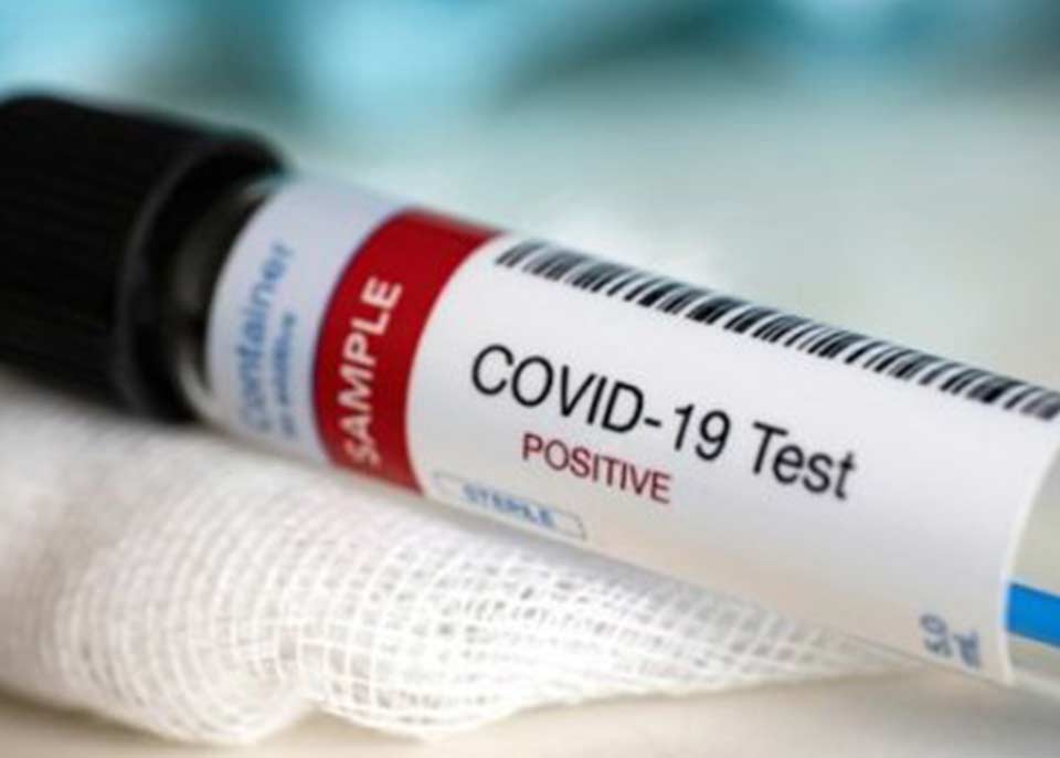 813 new cases of COVID-19 confirmed in Armenia