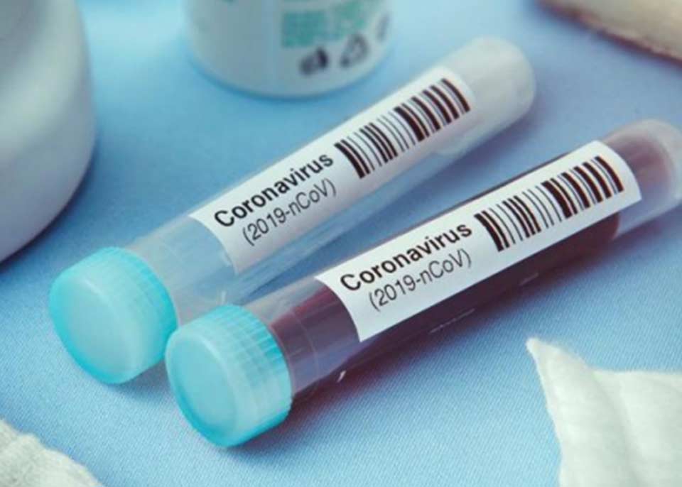 Ukraynada koronavirusun 5 334 yeni halı aşkar edildi