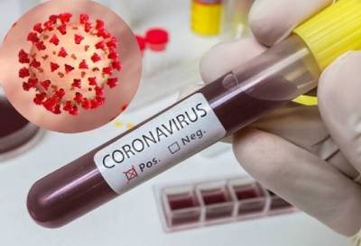 Ermənistanda son 24 saat ərzində koronavirusun 157 halı aşkar edildi