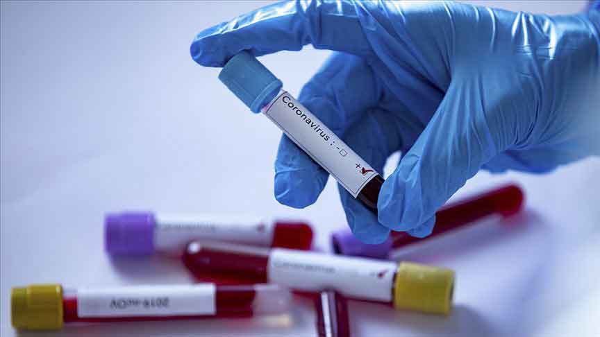 В оккупированной Абхазии выявлено 127 новых случаев коронавируса